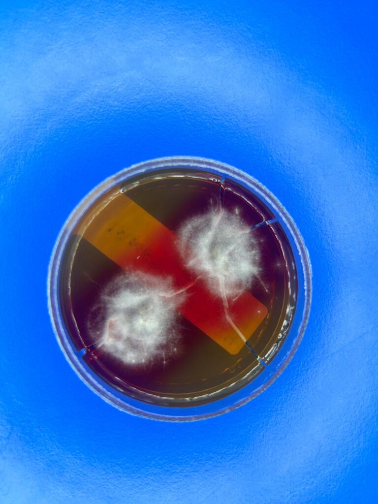 Dermatofitosis o tiña 4 WhatsApp Image 2024 07 11 at 11.14.12 1