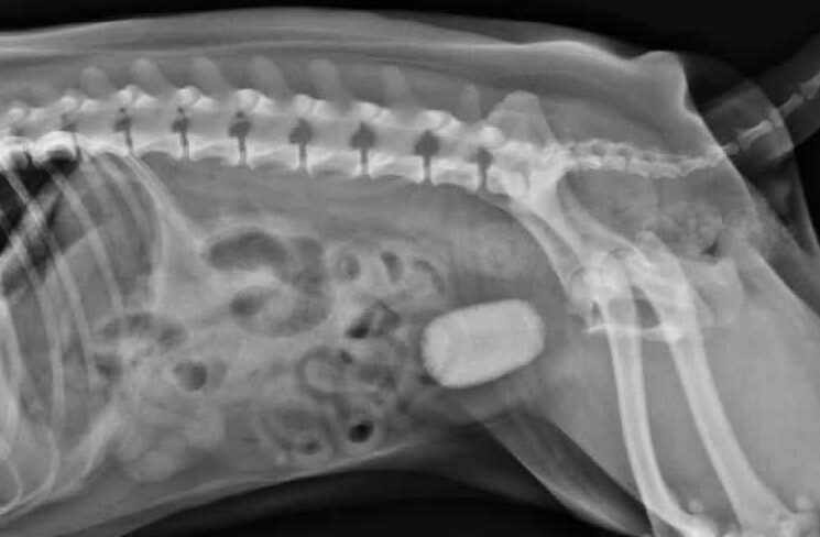 Cristales en la orina y Cálculos en la vejiga 2 AARU CALCULO edited